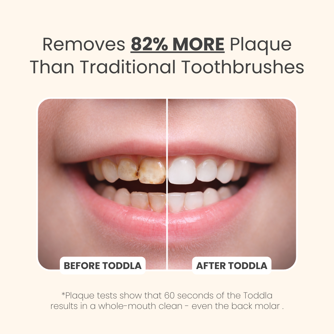 Toddla™ U-Shaped 360º Ultrasonic Toothbrush
